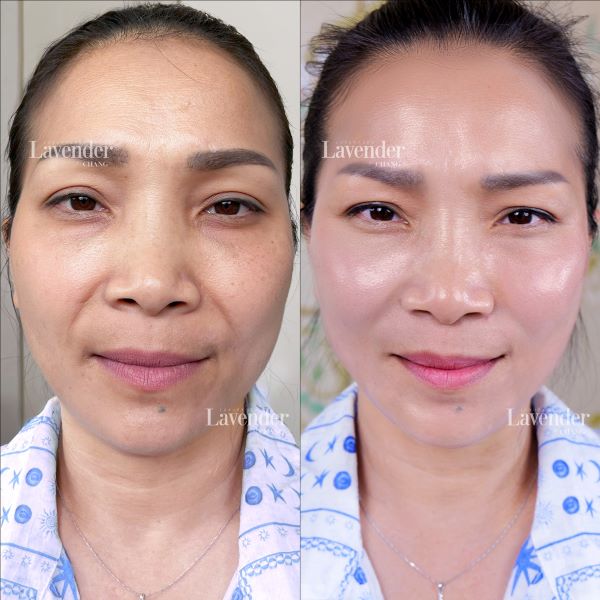 Ca sĩ Hồng Ngọc