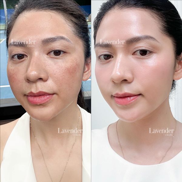 Khách hàng Lệ Hằng