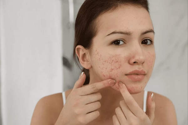 Chăm sóc da một cách thiếu hiểu biết cũng là nguyên nhân khiến da sớm bị chảy xệ