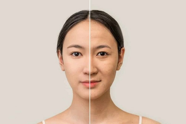 Tuổi tác càng cao khiến lượng nếp nhăn trên da xuất hiện ngày càng nhiều, nhất là ở vùng mặt