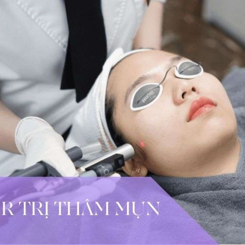 ban laser tri tham mun 11 - lavender by chang