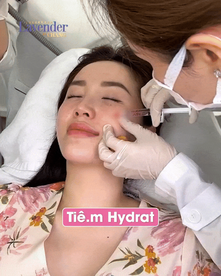 tiem filler co phai hydrat 3 1 - lavender by chang