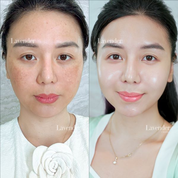 ban laser co de lai seo khong 11 - lavender by chang