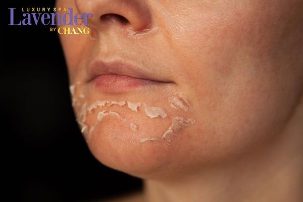 ban laser co de lai seo khong 5 - lavender by chang