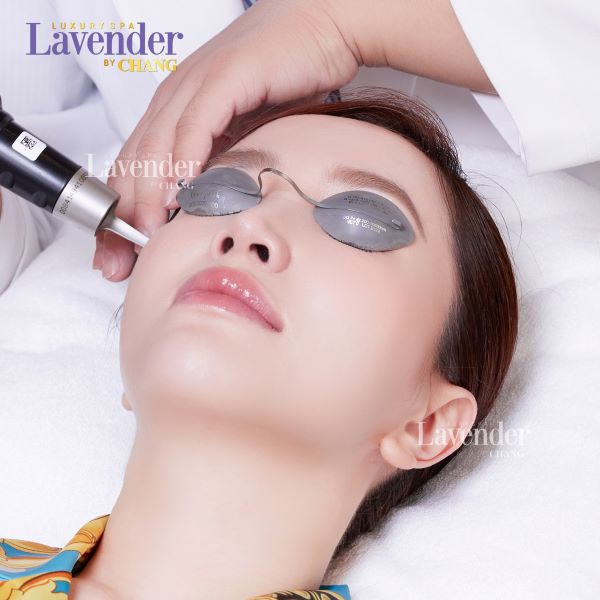 ban laser tri nam bao lau thi bong 3 - lavender by chang