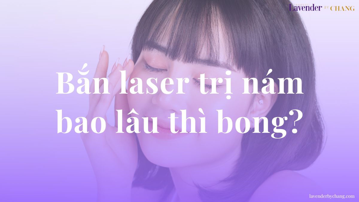 bắn laser trị nám bao lâu thì bong
