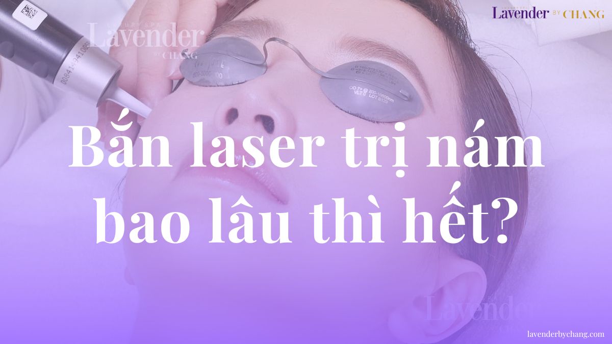 Bắn laser trị nám bao lâu thì hết