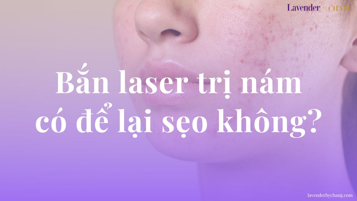 bắn laser trị nám có để lại sẹo không