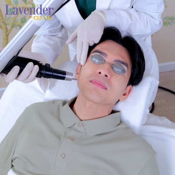 ban tia laser tri tan nhang bao nhieu tien 1 - lavender by chang