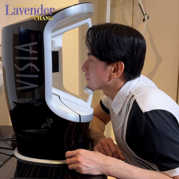 ban tia laser tri tan nhang bao nhieu tien 8 - lavender by chang