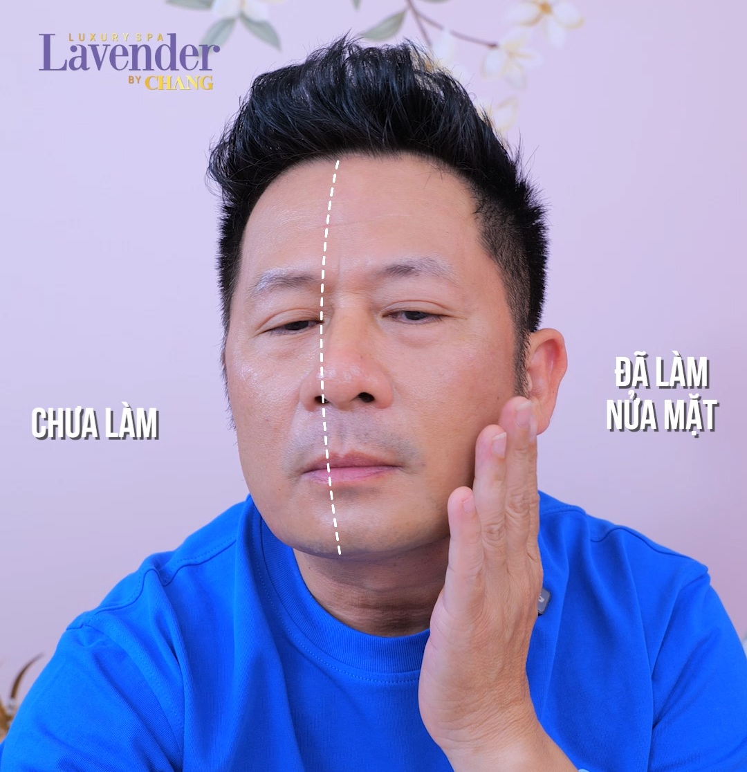 bang kiue lam thermage - lavender by chang