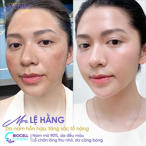 biocell complex gia bao nhieu 3 - lavender by chang