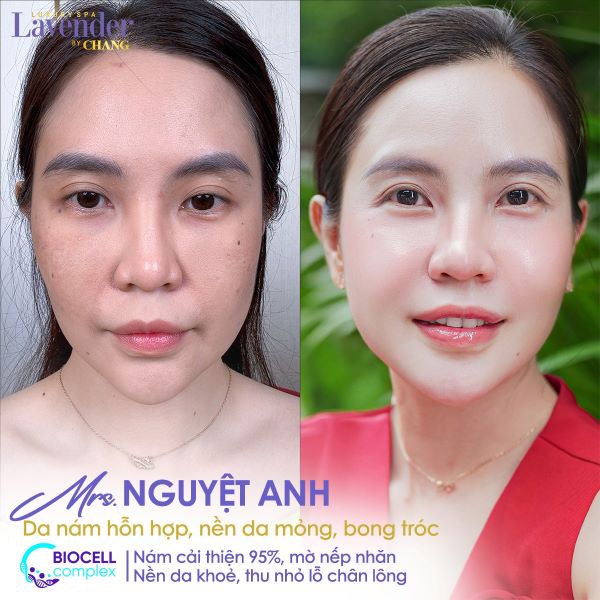 biocell complex gia bao nhieu 4 - lavender by chang