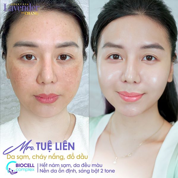 biocell complex gia bao nhieu 5 - lavender by chang