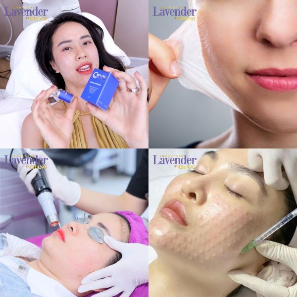 biocell complex gia bao nhieu 8 - lavender by chang