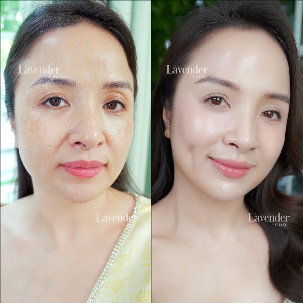 cach tri nam bang rau ngot 3 - lavender by chang