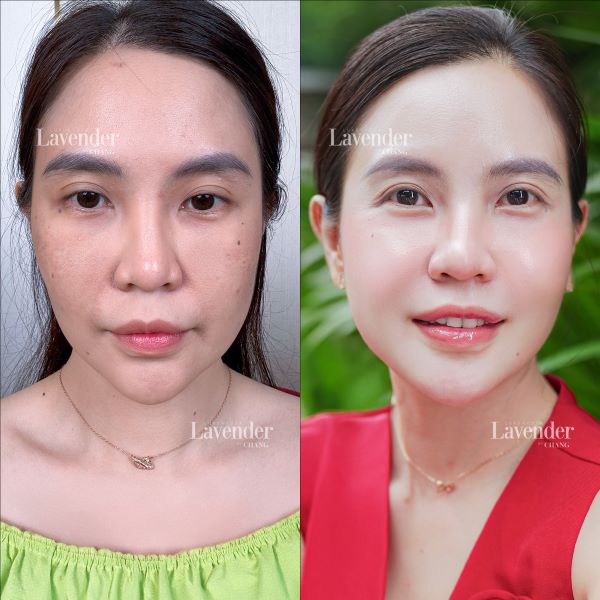 cach tri nam bang rau ngot 5 - lavender by chang