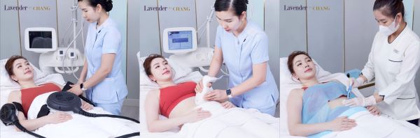 Cân nhắc sử dụng công nghệ giảm mỡ bụng không xâm lấn khi hạt chia không còn hiệu quả