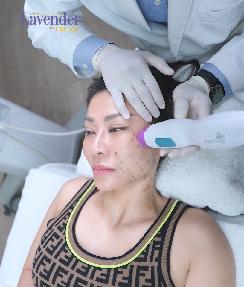 sao hai ngoai lam theramge - lavender by chang