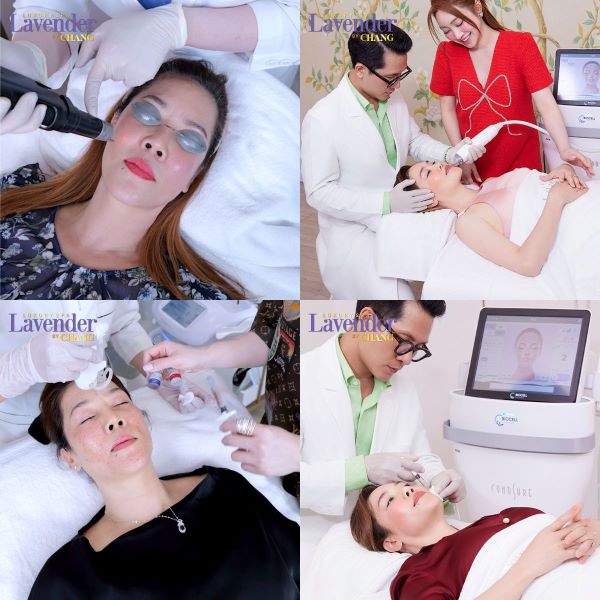 tri nam bang laser bao nhieu tien 2 - lavender by chang