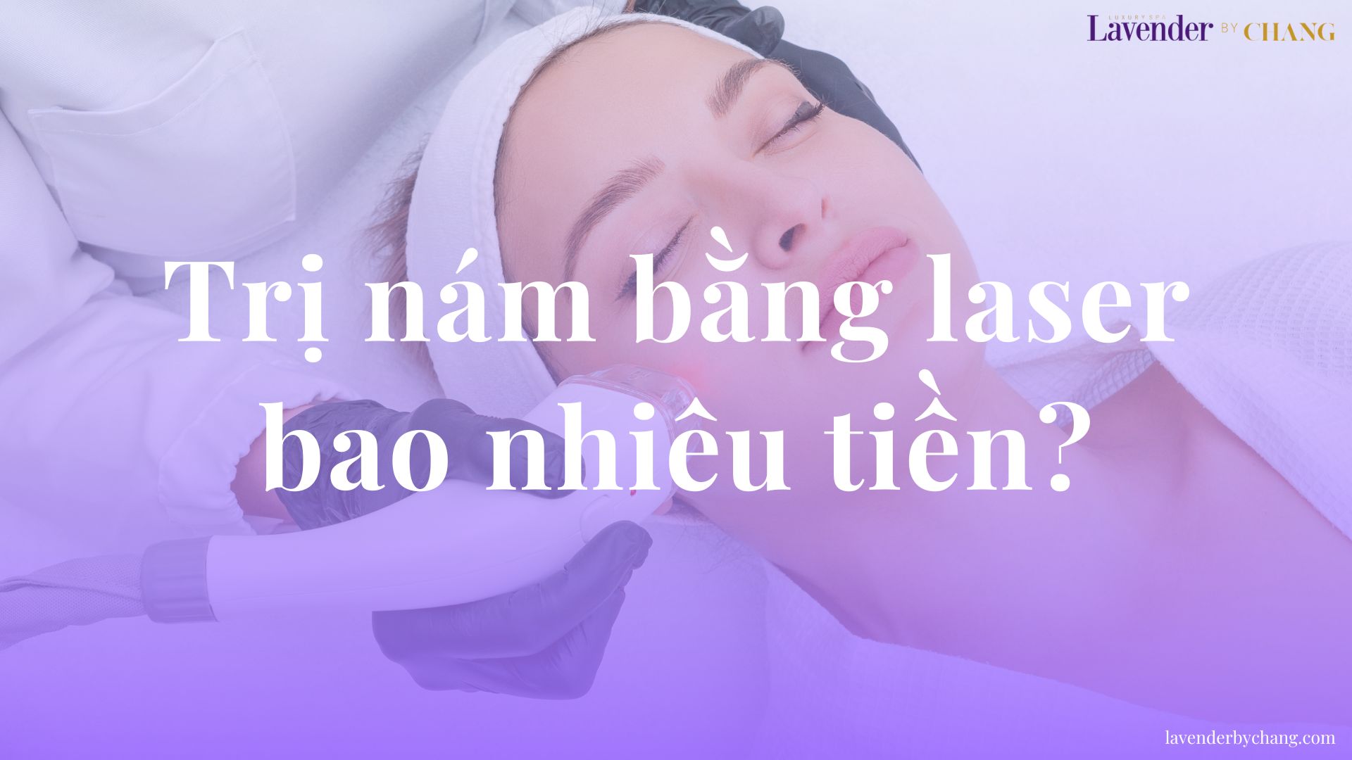 Trị nám bằng laser bao nhiêu tiền