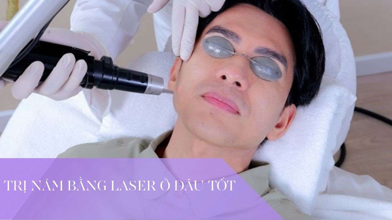 Trị nám bằng Laser ở đâu tốt? Tiêu chí chọn địa chỉ an toàn