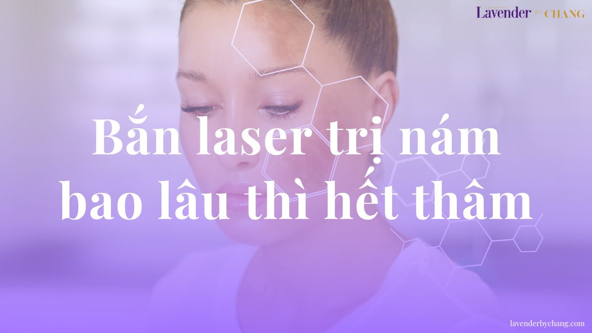 Bắn laser trị nám bao lâu thì hết thâm