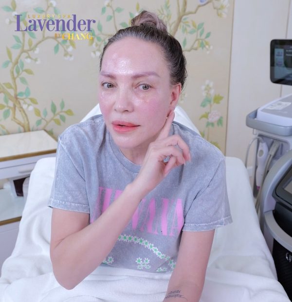 ban laser tri nam co dau khong 25458 1 e1763344655703 - lavender by chang