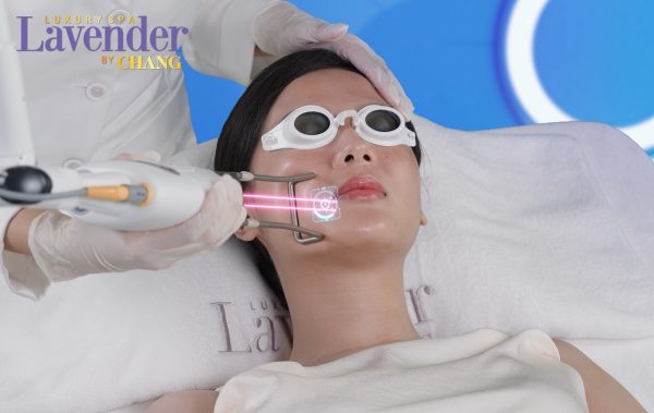 ban laser tri nam co dau khong 25458 2 e1763344639805 - lavender by chang