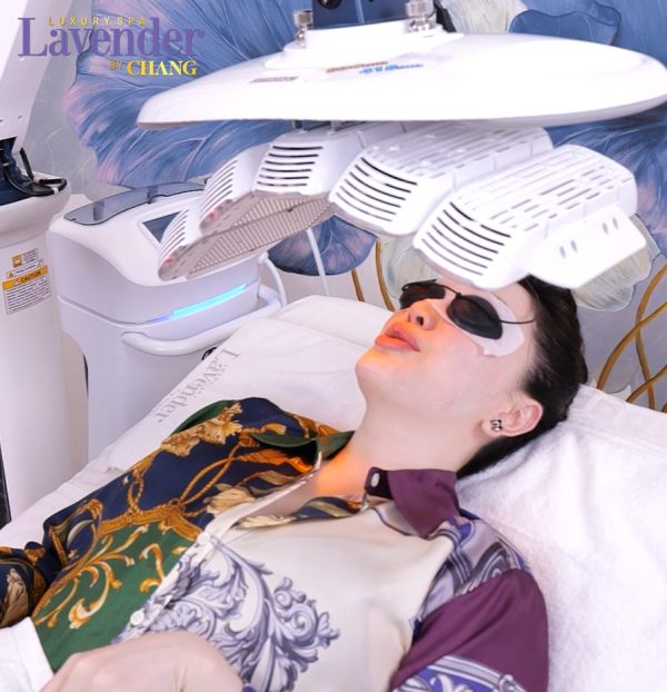 ban laser tri nam co dau khong 25458 5 e1763344555359 - lavender by chang