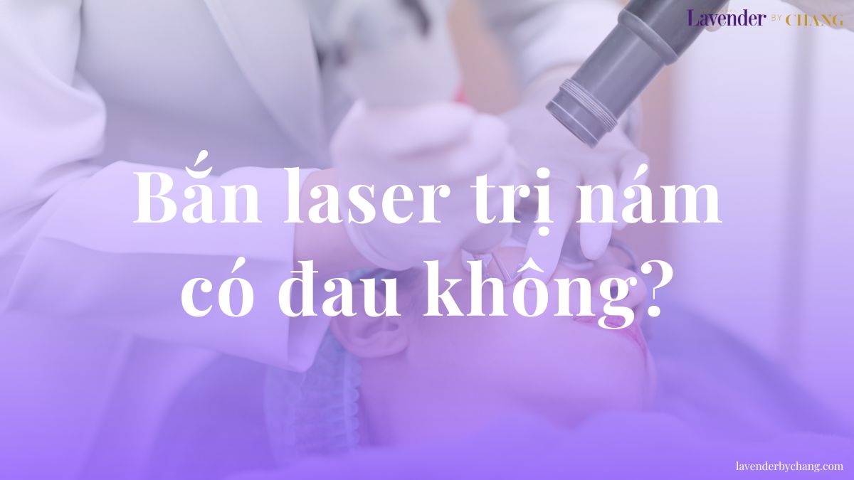 Bắn laser trị nám có đau không