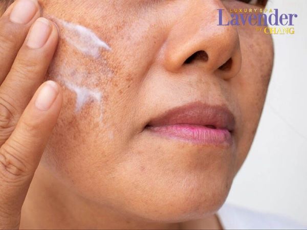 cach cham soc da sau khi ban laser tri nam 6 - lavender by chang