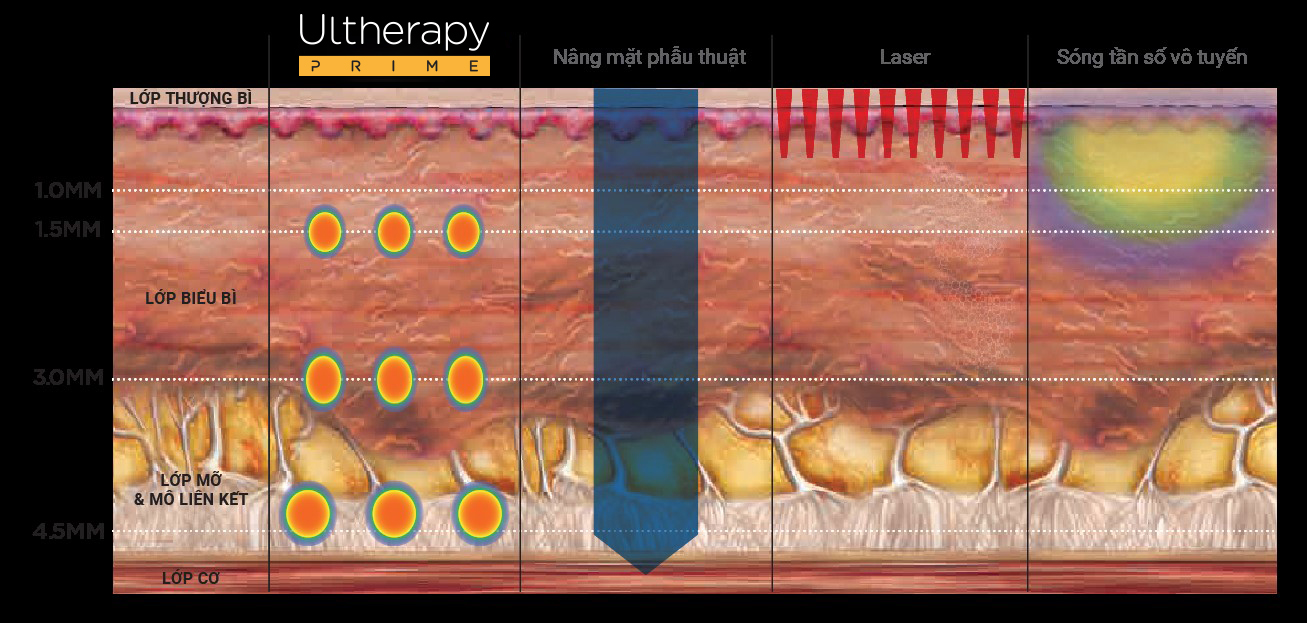 chi bon tien tre hoa da2 - lavender by chang