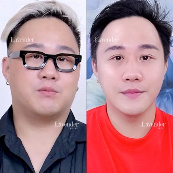 nen lam ultherapy o dau 25307 6 e1762998403173 - lavender by chang