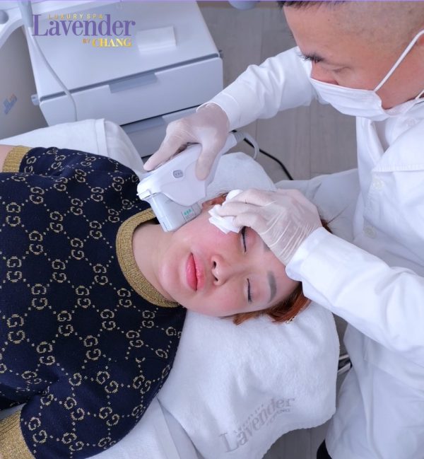 nen lam ultherapy o dau 25307 e1762998329691 - lavender by chang
