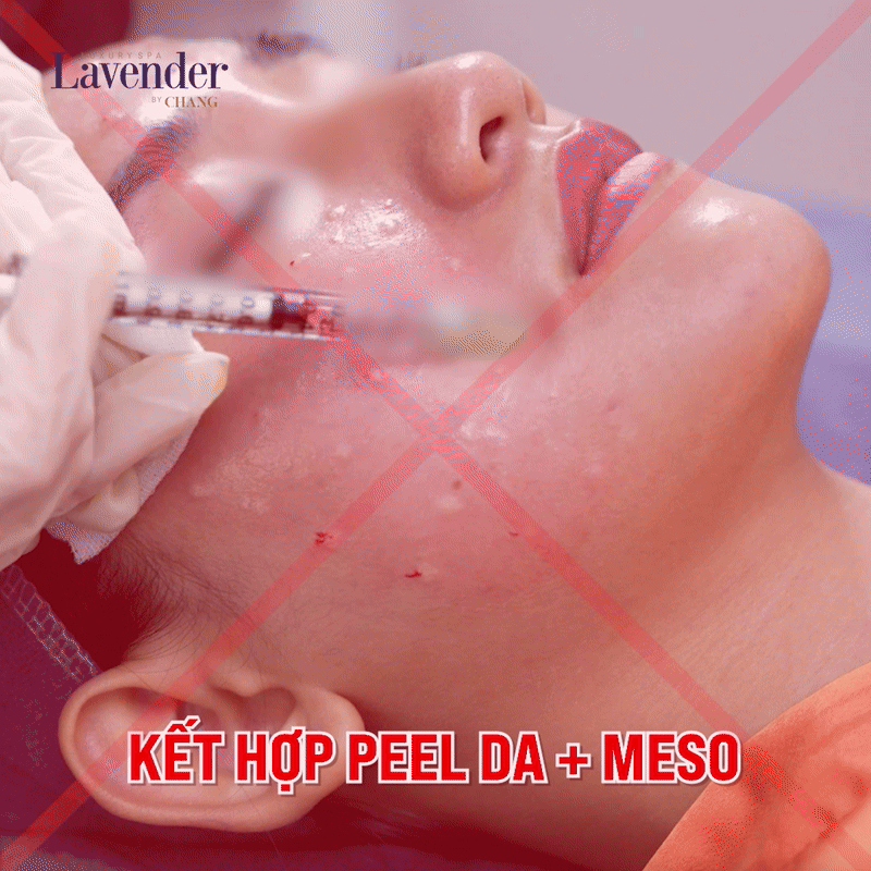 peel da tiem meso 2 - lavender by chang