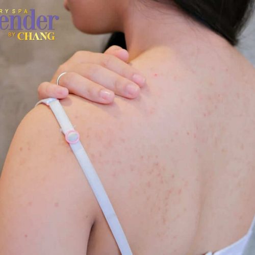 tam trang noi mun lung1 - lavender by chang