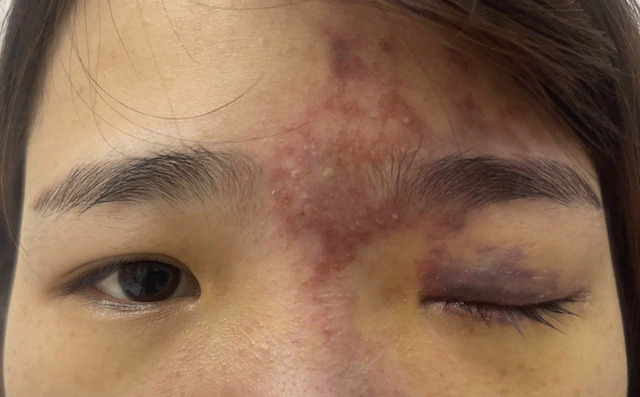 tiem collagen 2 - lavender by chang