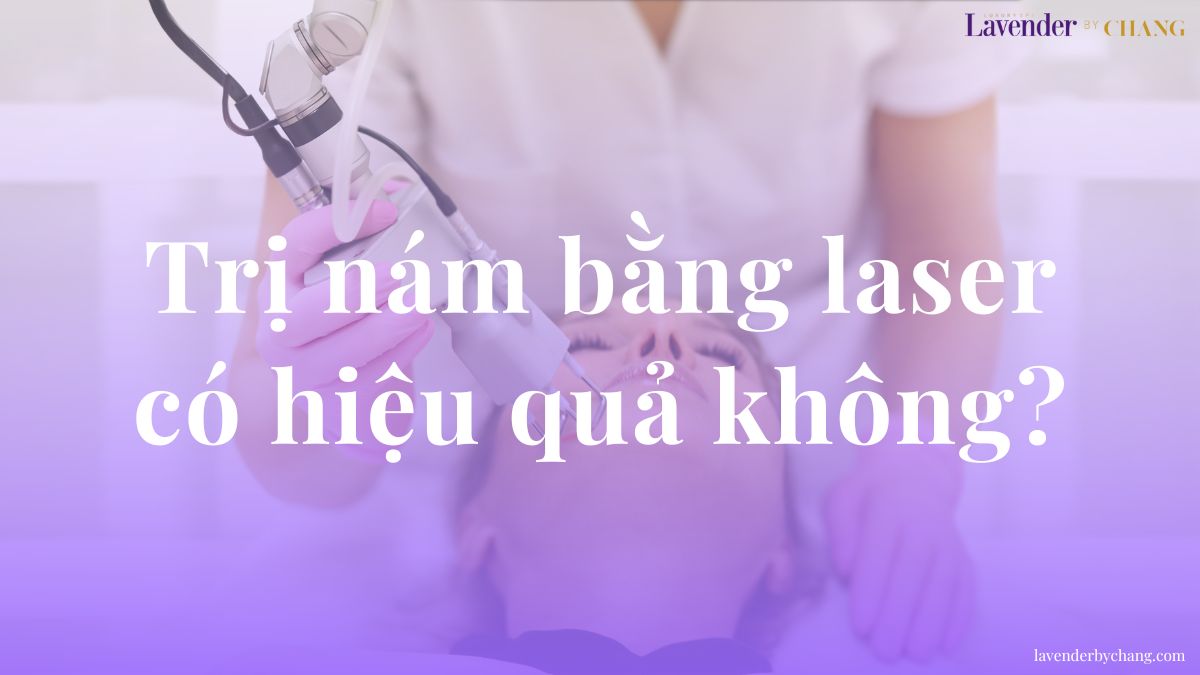 Trị nám bằng laser có hiệu quả không