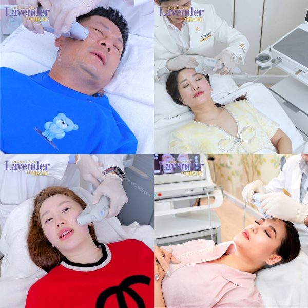 ultherapy prime gia bao nhieu 25683 2 - lavender by chang