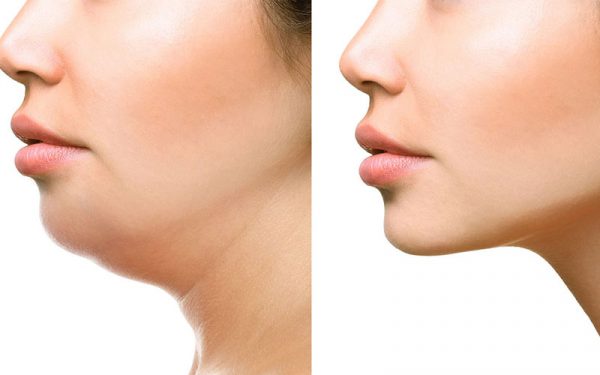 cham soc sau hut mo nong cam 26117 1 e1764564026301 - lavender by chang