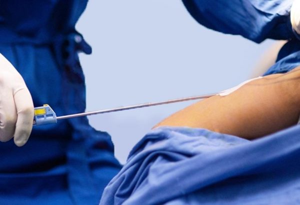 hut mo bap tay co dau khong 26316 e1765246724332 - lavender by chang