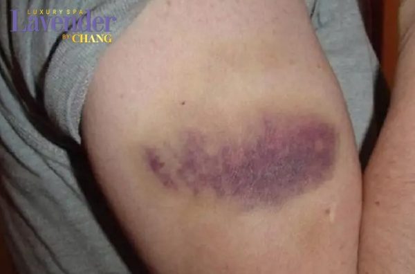 hut mo bap tay co to lai khong 26299 4 e1765245104481 - lavender by chang