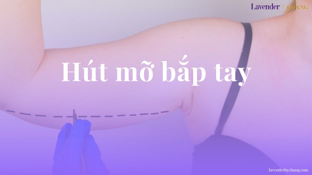 hút mỡ bắp tay