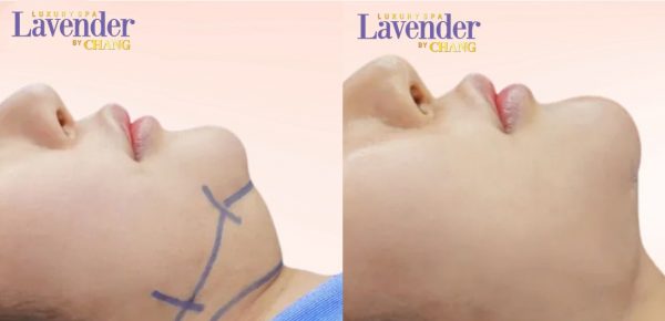 hut mo nong cam 26221 1 e1765159478862 - lavender by chang