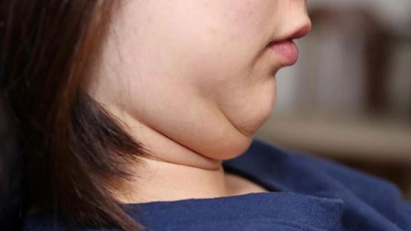 hut mo nong cam co bi lai khong 26105 2 e1764563049914 - lavender by chang