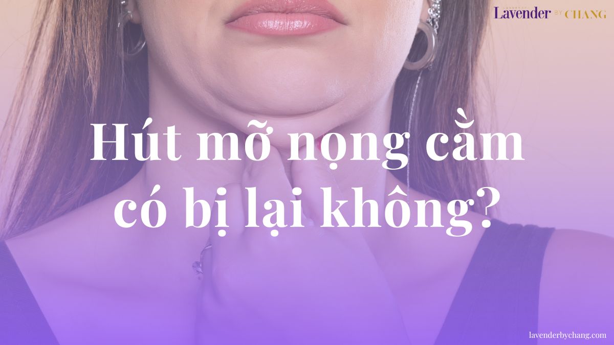 Hút mỡ nọng cằm có bị lại không