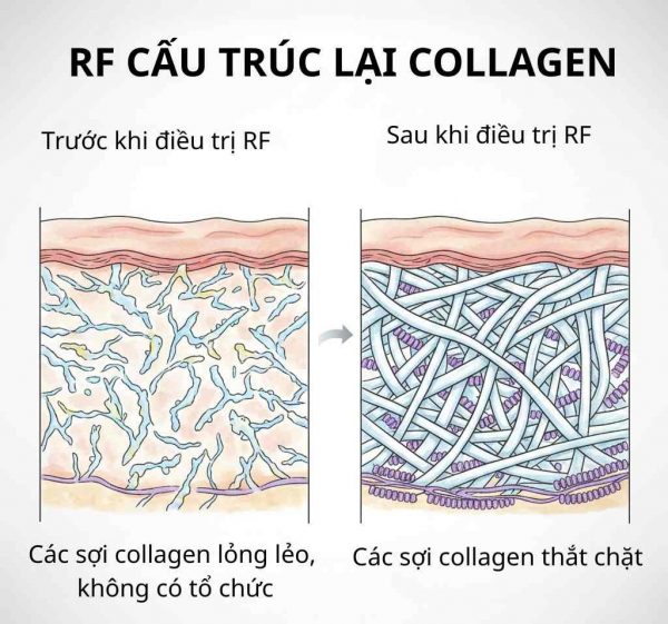 nang co thermage 26167 1 e1764730661509 - lavender by chang