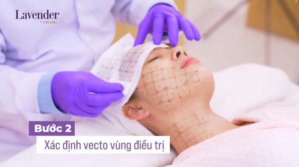 nang co thermage 26167 6 e1764730739354 - lavender by chang