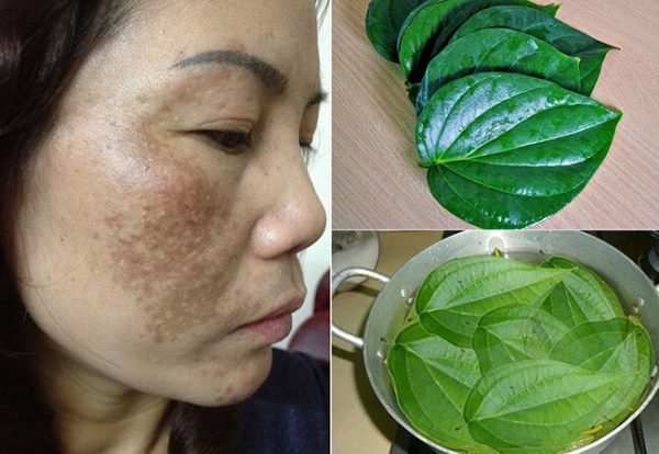 tac hai cua tri nam bang la trau khong 26479 e1765938732303 - lavender by chang